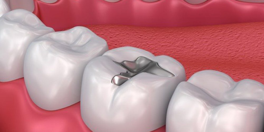 Endodontics