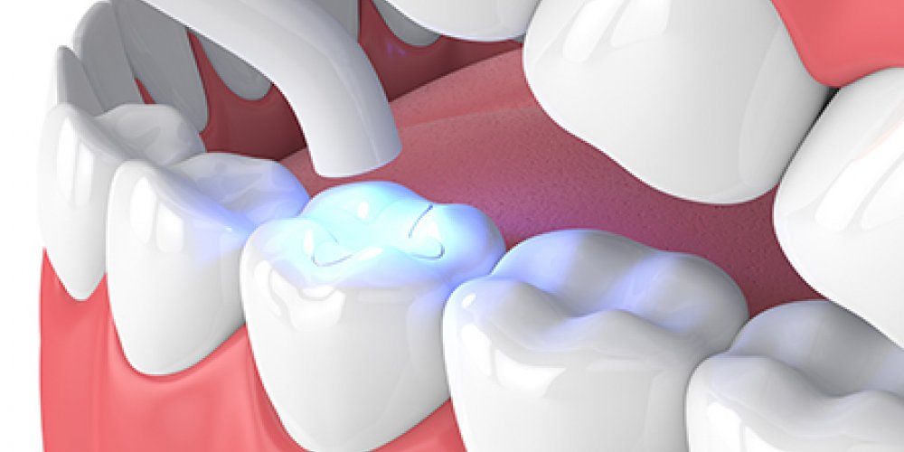 Endodontics